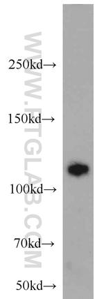 Rabenosyn 5 Antibody in Western Blot (WB)