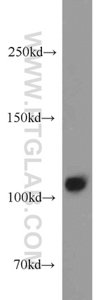 Rabenosyn 5 Antibody in Western Blot (WB)