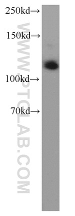 Rabenosyn 5 Antibody in Western Blot (WB)