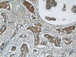 CSE1L Antibody in Immunohistochemistry (Paraffin) (IHC (P))