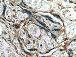 CSE1L Antibody in Immunohistochemistry (Paraffin) (IHC (P))