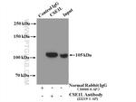 CSE1L Antibody in Immunoprecipitation (IP)