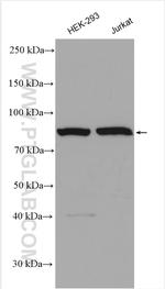 CSE1L Antibody in Western Blot (WB)