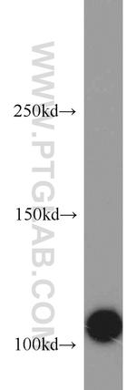 CSE1L Antibody in Western Blot (WB)