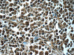 CSE1L Antibody in Immunohistochemistry (Paraffin) (IHC (P))