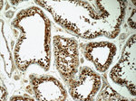 CSE1L Antibody in Immunohistochemistry (Paraffin) (IHC (P))