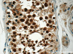 CSE1L Antibody in Immunohistochemistry (Paraffin) (IHC (P))