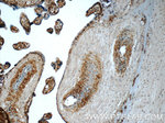 CSE1L Antibody in Immunohistochemistry (Paraffin) (IHC (P))