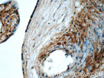 CSE1L Antibody in Immunohistochemistry (Paraffin) (IHC (P))