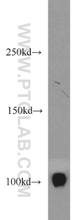 CSE1L Antibody in Western Blot (WB)