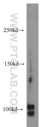 CSE1L Antibody in Western Blot (WB)