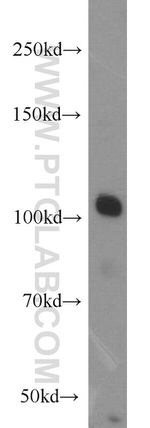 CSE1L Antibody in Western Blot (WB)