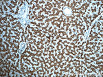 ALDH1B1 Antibody in Immunohistochemistry (Paraffin) (IHC (P))