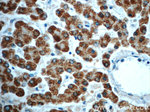 ALDH1B1 Antibody in Immunohistochemistry (Paraffin) (IHC (P))