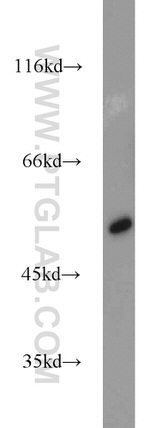 ALDH1B1 Antibody in Western Blot (WB)