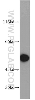 ALDH1B1 Antibody in Western Blot (WB)