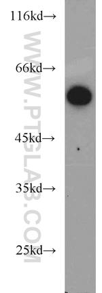 ALDH1B1 Antibody in Western Blot (WB)