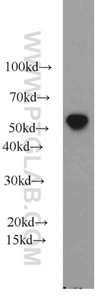 ALDH1B1 Antibody in Western Blot (WB)