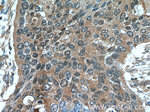 Cytokeratin 14 Antibody in Immunohistochemistry (Paraffin) (IHC (P))