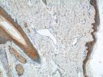 Cytokeratin 14 Antibody in Immunohistochemistry (Paraffin) (IHC (P))