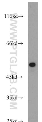 Cytokeratin 14 Antibody in Western Blot (WB)