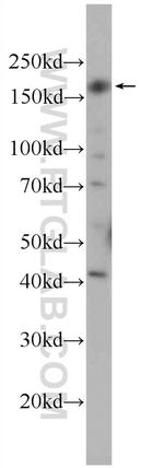 CEP164 Antibody in Western Blot (WB)