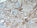 TIMM50 Antibody in Immunohistochemistry (Paraffin) (IHC (P))