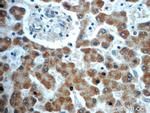 TIMM50 Antibody in Immunohistochemistry (Paraffin) (IHC (P))