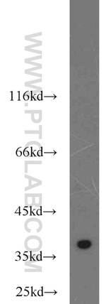 TIMM50 Antibody in Western Blot (WB)