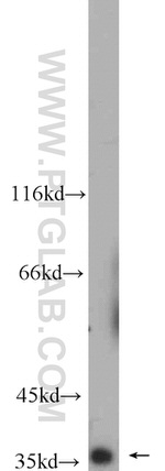 TIMM50 Antibody in Western Blot (WB)