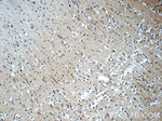 HIP1 Antibody in Immunohistochemistry (Paraffin) (IHC (P))