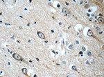 HIP1 Antibody in Immunohistochemistry (Paraffin) (IHC (P))