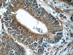 HIP1 Antibody in Immunohistochemistry (Paraffin) (IHC (P))