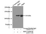 HIP1 Antibody in Immunoprecipitation (IP)