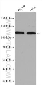 HIP1 Antibody in Western Blot (WB)