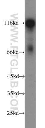 HIP1 Antibody in Western Blot (WB)