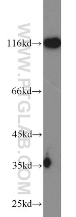 HIP1 Antibody in Western Blot (WB)