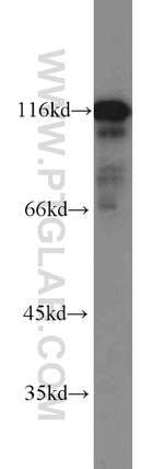 HIP1 Antibody in Western Blot (WB)