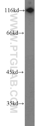 HIP1 Antibody in Western Blot (WB)