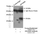 ADAM28 Antibody in Immunoprecipitation (IP)