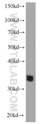 ADAM28 Antibody in Western Blot (WB)