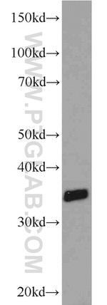 ADAM28 Antibody in Western Blot (WB)