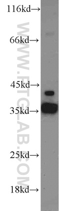 ADAM28 Antibody in Western Blot (WB)