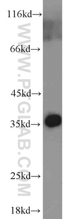 ADAM28 Antibody in Western Blot (WB)