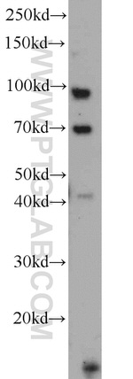 TLR6 Antibody in Western Blot (WB)