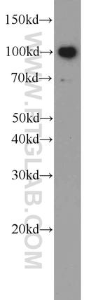 TLR6 Antibody in Western Blot (WB)