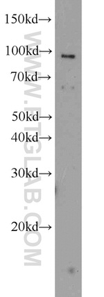 TLR6 Antibody in Western Blot (WB)