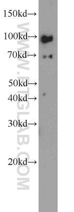 TLR6 Antibody in Western Blot (WB)