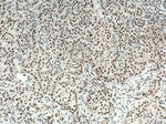 REST Antibody in Immunohistochemistry (Paraffin) (IHC (P))