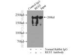 REST Antibody in Immunoprecipitation (IP)